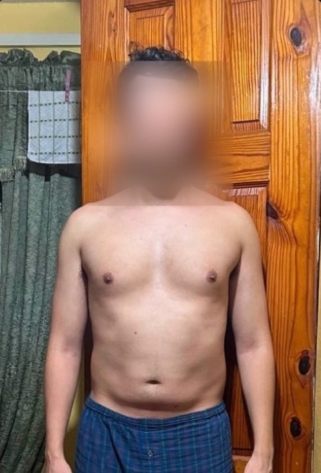 Client before, face blurred