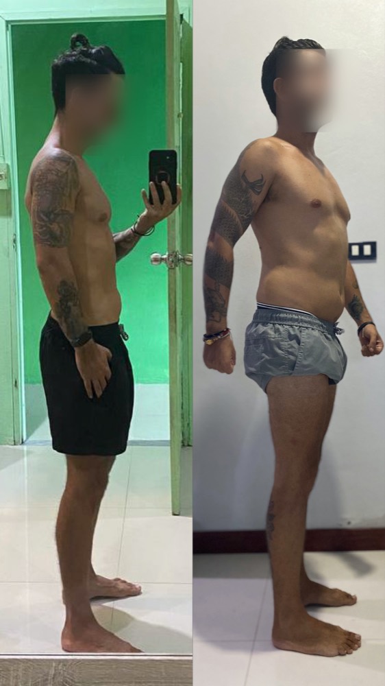 Client side-view progress, face blurred
