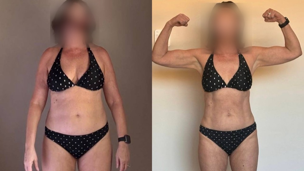 Client before and after, face blurred